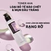 Cosrx AHA 7 Whitehead Power Liquid loại bỏ tế bào chết và mụn đầu trắng