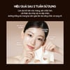 Mặt nạ thạch d'Alba Vita Capsule Anti-Aging Hydrogel Mask mặt nạ sử dụng sau 2 tuần