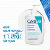 Sữa rửa mặt giảm mụn CeraVe Blemish Control Cleanser 473ml giúp giảm mụn sau 1 tuần