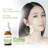 Serum hỗ trợ giảm mụn Dr.PONG cải thiện tình trạng mụn