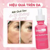 Hiệu quả trên da Timeless Matrixyl Synthe 6 serum