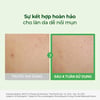 Trước và sau khi sử dụng Serum làm dịu phục hồi da Torriden BALANCEFUL serum