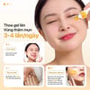 Hướng dẫn sử dụng Gel nghệ NeoCurma