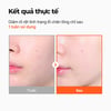 Kết quả thực tế Tinh chất Isntree Hyper Niacinamide 20 Serum