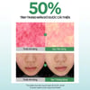 Trước và sau khi sử dụng Tinh chất phục hồi da JUMISO D-Panthenol Barrier Soothing Serum 70ml