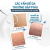 Các vấn đề da thường gặp phải