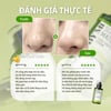 Đánh giá thực tế Some By Mi Super Matcha Pore Tightening Serum