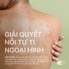 Sữa tắm giảm mụn lưng Neo Acnes 250ml giải quyết nỗi tự ti ngoại hình