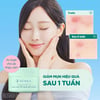 Hiệu quả sử dụng Kem dưỡng cho da mụn Senka Acne Care 3X Repair Gel Cream 50g