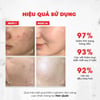 Hiệu quả sử dụng Nước thần kiềm dầu trắng da Angel’s Liquid Glutathione+ Niacinamide Cica Essence 150ml