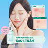 Hiệu quả sử dụng Tinh chất dưỡng cho da mụn Senka Acne Care 3X Repair Serum 30ml