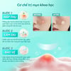 Hướng dẫn sử dụng Miếng dán mụn LANBENA Invisible Acne Pimple Patch Day Use