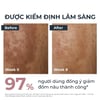 Kem dưỡng Eucerin Spotless Brightening được kiểm định lâm sàng