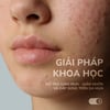 Hướng dẫn sử dụng Gel giảm mụn Neothera Acnes Gel hỗ trợ giảm mụn, giảm nhờn