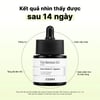 Cosrx The Retinol 0.5 Oil kết quả sau 14 ngày