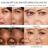 Kem nền Estee Lauder Double Wear Stay-in-Place SPF 10/PA++ 30ml giải quyết các khuyết điểm của da