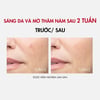 Hiệu quả sử dụng Serum Vichy Liftactiv B3 Dark Spots 30ml
