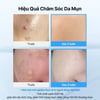 Hiệu quả sử dụng Dear Klairs EGF Blue AC Calming Serum