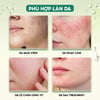 Serum cấp ẩm phục hồi da Timeless B5 Hydration Serum 120ml phù hợp làn da