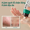 Hiệu quả sử dụng Some By Mi AHA-BHA-PHA 30 Days Miracle Acne Clear Foam