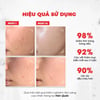 Hiệu quả sử dụng Kem kiềm dầu trắng da Angel’s Liquid Glutathione+ Niacinamide Cica Cream 45ml