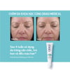 Trước và sau khi sử dụng Obagi 360 Retinol 0.5