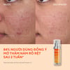 Trước và sau khi sử dụng Tinh chất mờ nám Murad Rapid Dark Spot Correcting Serum 30ml