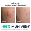 Tinh chất giảm mụn Eucerin DermoPure Clinical Triple Action
