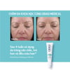 Trước và sau khi sử dụng Obagi Retinol 1.0