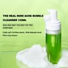 Công dụng Sữa rửa mặt giảm mụn Celimax The Real Noni Acne Bubble Cleanser 155ml