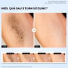 Máy triệt lông Halio SilkGlow IPL Sapphire Cooling Hair Removal Device hiệu quả sau 3 tuần sử dụng