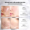 Hiệu quả sử dụng Serum kiềm dầu Neogen Dermalogy Real Niacinamide Serum 30ml