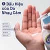 5 đấu hiệu của da nhạy cảm Sữa rửa mặt CETAPHIL GENTLE SKIN CLEANSER