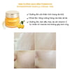 Hiệu quả sử dụng Kem Forencos vàng 50ml