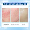 Timeless Hyaluronic Acid + Vitamin C phù hợp với mọi loại da