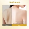 Hiệu quả sử dụng Sữa tắm giảm mụn Grace and Glow