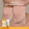 Hiệu quả sử dụng Gel nghệ NeoCurma