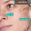 Kết cấu Serum giảm mụn Uriage Hyseac Serum Booster Anti-Imperfections 30ml