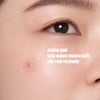 Miếng dán mụn siêu mỏng BENZAC Power Patch