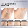 Máy triệt lông lạnh Halio InfinityGlow Advanced IPL Cooling Hair Removal Device hiệu quả triệt lông sau 4 tuần