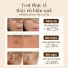 Test thực tế Tinh chất sáng da Carslan Skin Brightening Serum 30ml