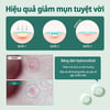 Hiệu quả miếng dán mụn Some By Mi Clear Spot Patch