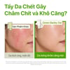 Trước và sau khi sử dụng Gel tẩy tế bào da chết INNISFREE Green Barley Mild Peeling Gel 120ml