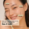 Cosrx The Retinol 0.5 Oil kết quả sử dụng sau 4 tuần