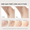 Máy triệt lông trẻ hóa da Halio IPL Cooling Hair Removal Device hiệu quả triệt lông sau 8 tuần