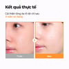 kết quả thực tế Isntree Hyper Vitamin C 23 Serum