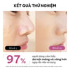 kết quả thử nghiệm Tinh chất tẩy tế bào chết Bye Bye Blemish Skin Resurfacing Peel Serum