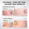 Hiệu quả sử dụng Gel giảm mụn LUCENBASE 377 Salicylic Acid 20g