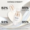 Hiệu quả sử dụng Tinh chất Shiseido Benefiance Brightening Micro-Spot Serum