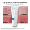 Hiệu quả sử dụng Kem dưỡng ẩm La Roche-Posay Cicaplast Baume B5+ 40ml